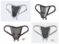 Alba Racing - ARMAT by Alba Racing Yamaha Raptor 700 M2 Front Bumper (Black, Silver, Red, Blue,Green,Gold,Orange)